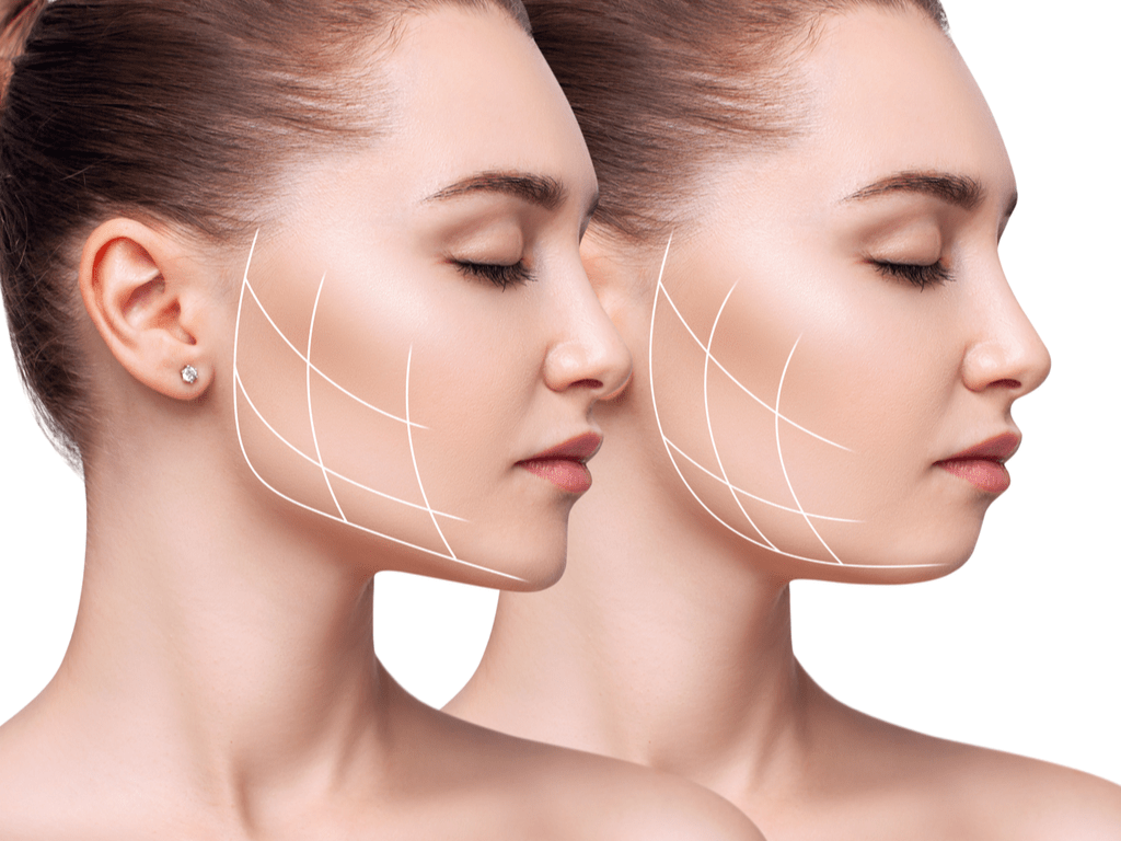 Preenchimento Facial: Redefina o Contorno do Seu Rosto e Volte no Tempo